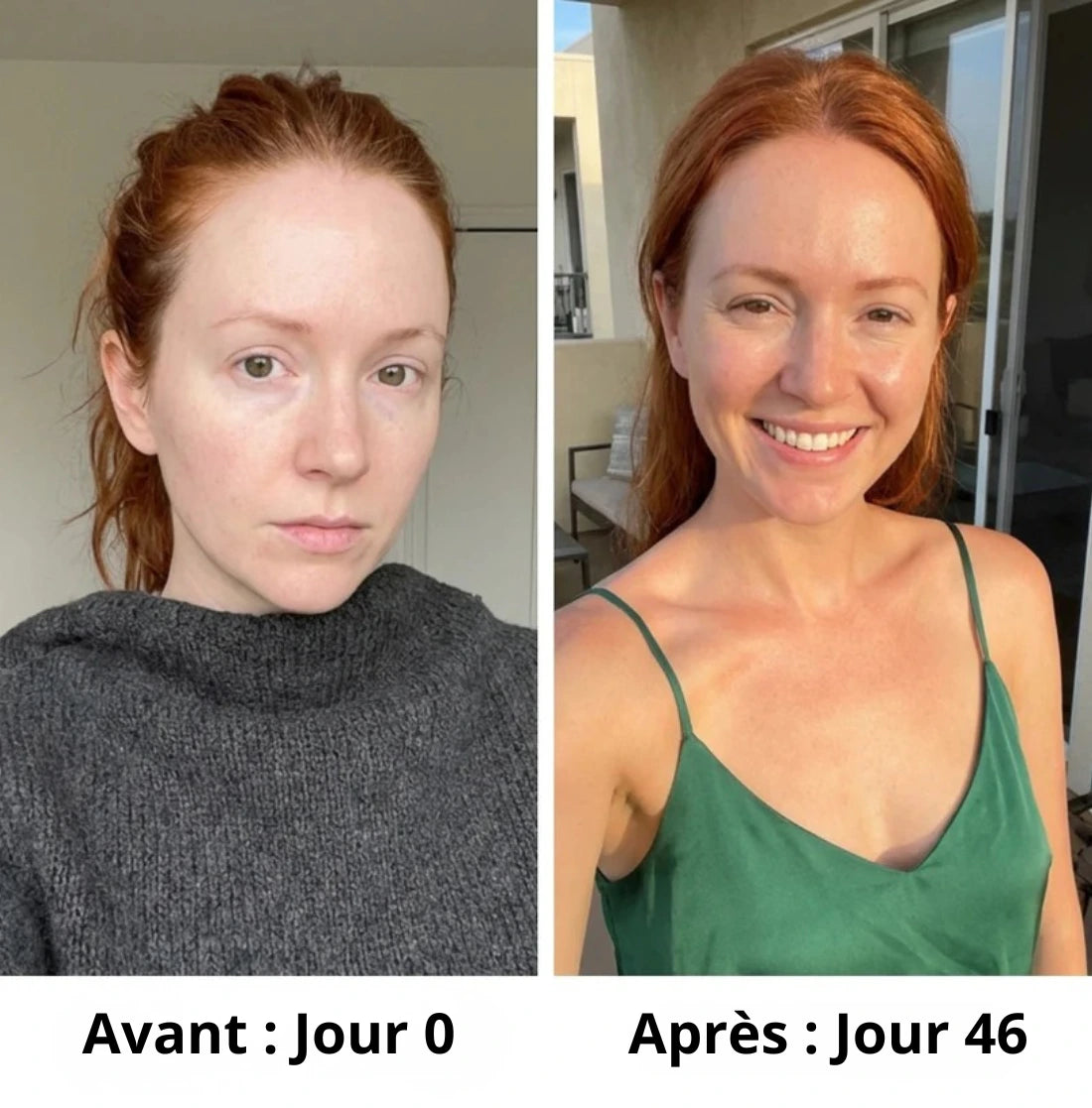 Gummies Bronzage Naturel